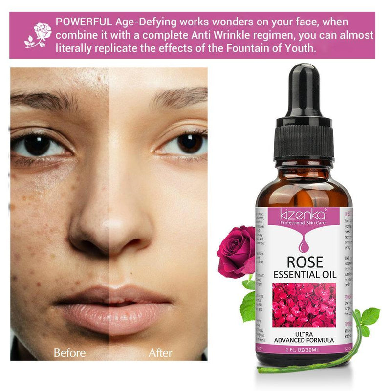 Kizenka Rose Essential Oil - Powerful Natural Age-Defying Skin Treatme